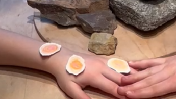 Eine Hand mit gelblichen Flecken, eine andere Hand kommt langsam darüber, im Hintergrund große Steine